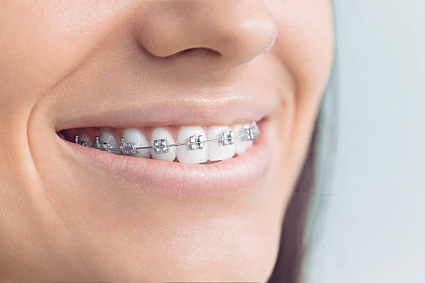 Best Veneers and Lumineers  in Medford, MA